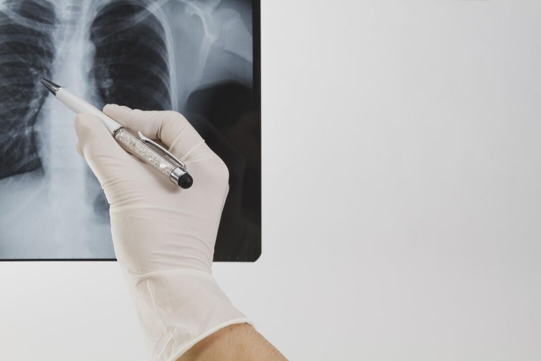 اشعه ایکس برای تشخیص پوکی استخوان