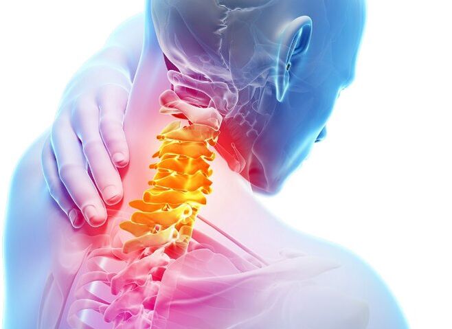 علائم و مراحل توسعه پوکی استخوان گردن رحم