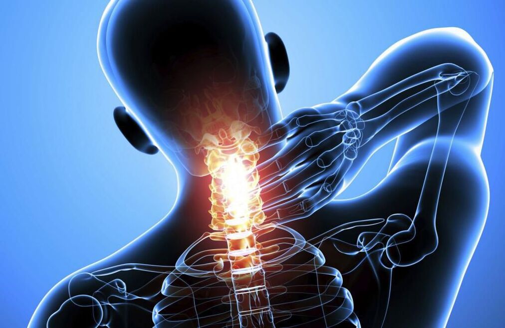 پوکی استخوان ستون فقرات گردن رحم
